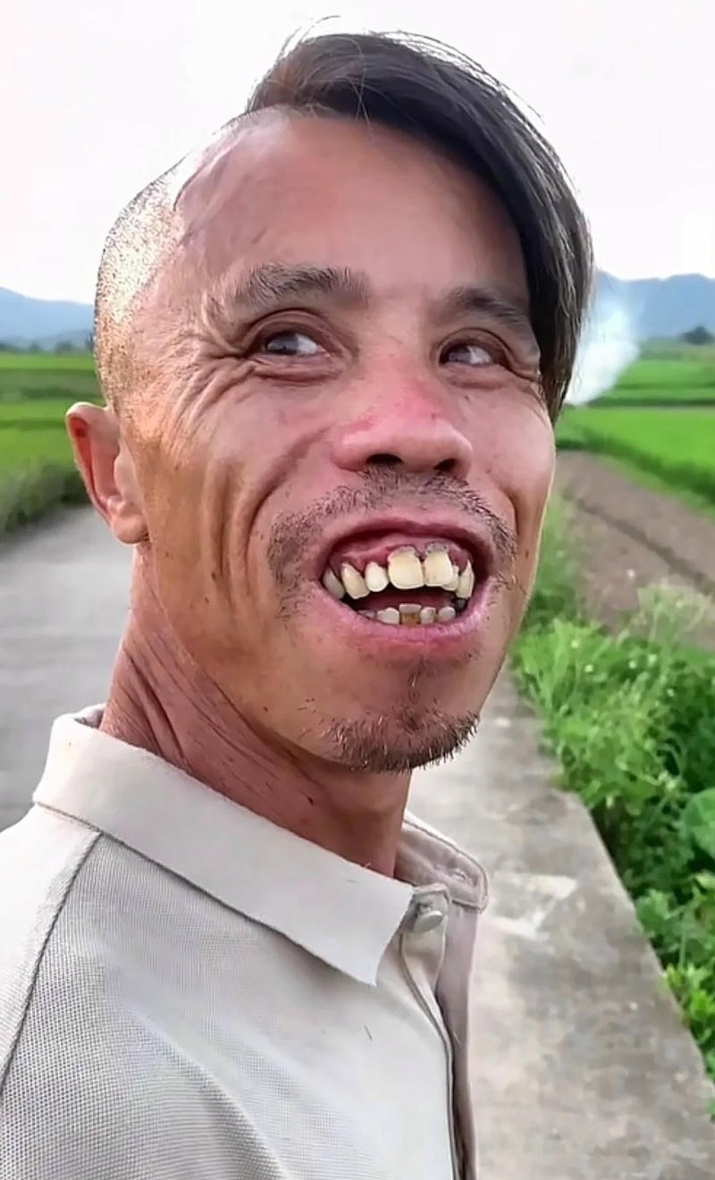 ảnh trai xấu giản dị